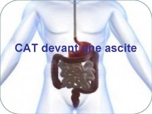 CAT devant une ascite Dfinition panchement de liquide