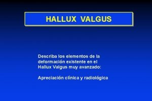 HALLUX VALGUS Describa los elementos de la deformacin