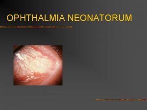OPHTHALMIA NEONATORUM OPHTHALMIA NEONATORUM n Neonatal conjunctivitis in