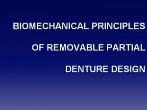Principles of removable partial denture design