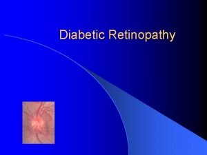 Diabetic Retinopathy Epidemiology l l l The World