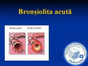 Broniolita acut Introducere n Broniolita acut n este