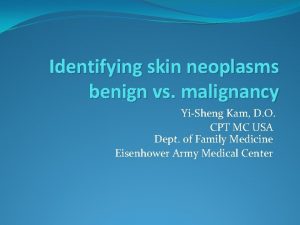 Seborrheic keratoses Seborrheic keratoses