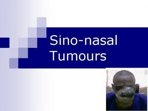 Sinonasal Tumours n Tumors of the nasal cavity