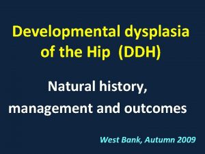 Developmental dysplasia of the Hip DDH Natural history