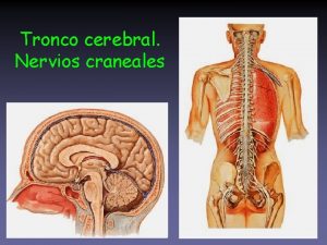 Tallo cerebral Tallo cerebral