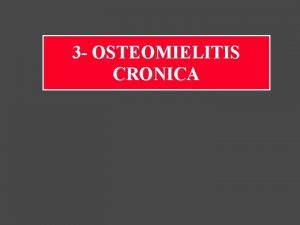 Artrita infectioasa Artrita infectioasa
