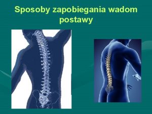 Sposoby zapobiegania wadom stóp