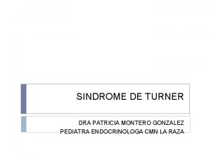 Sindrome de turner