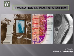 EVALUATION DU PLACENTA PAR IRM M Tebache CHR