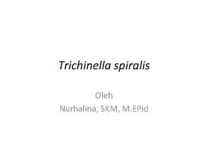 Trichinella spiralis Oleh Nurhalina SKM M EPid Pendahuluan