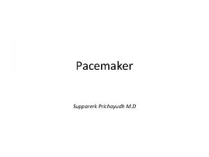 Failure to fire pacemaker