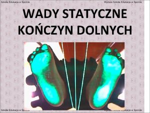 WADY STATYCZNE KOCZYN DOLNYCH BUDOWA I CZYNNO STOPY