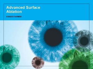 Advanced Surface Ablation KHADER FARWAN How the eye