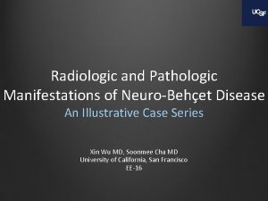 Radiologic and Pathologic Manifestations of NeuroBehet Disease An