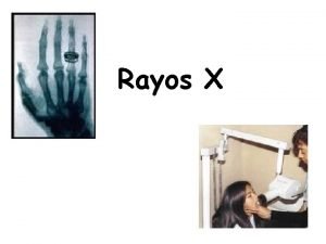 Rayos