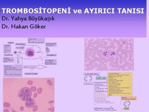 TROMBOSTOPEN ve AYIRICI TANISI Dr Yahya Bykak Dr