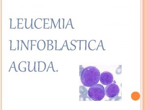 LEUCEMIA LINFOBLASTICA AGUDA LA LEUCEMIA ES UN GRUPO