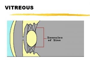 VITREOUS VITREOUS LECTURE z Reading Assignment Adlers Chapter