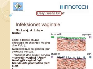 Infeksionet vaginale