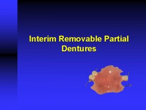 Interim Removable Partial Dentures Interim Removable Partial Dentures