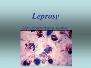 Leprosy Mycobacterium leprae Quick Reference Environment human mice