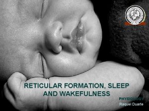 Reticular formation and sleep
