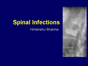 Spinal Infections Himanshu Sharma Spinal Infections Objectives Epidemiology