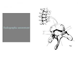 Radiographic assessment Radiographic assessment Valuable Dx tool To