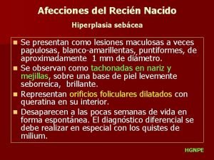 Afecciones del Recin Nacido Hiperplasia sebcea n n