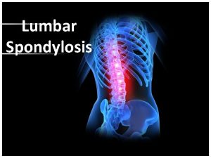 Lumbar Spondylosis CONTENT Anatomy of the vertebral column