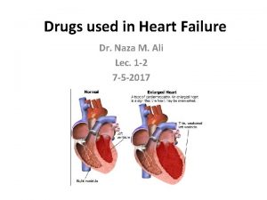 Drugs used in Heart Failure Dr Naza M