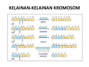 KELAINANKELAINAN KROMOSOM Kelainan kromosom dapat dibedakan menjadi 2