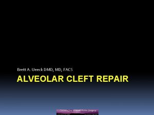 Brett A Ueeck DMD FACS ALVEOLAR CLEFT REPAIR