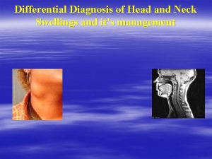 Scalp swelling differential diagnosis Scalp swelling differential diagnosis
