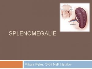 SPLENOMEGALIE Mikula Peter OKH Ns P Haviov Funkce