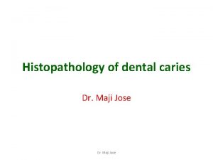 Histopathology of dental caries Dr Maji Jose Smooth
