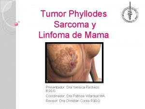 Tumor Phyllodes Sarcoma y Linfoma de Mama Presentador