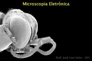 Microscopia Eletrnica Prof Jos Lino Neto UFV Microscpio