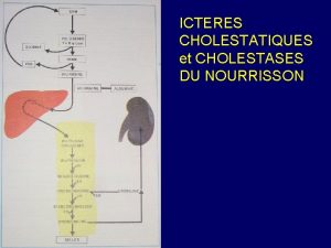 Cholestase