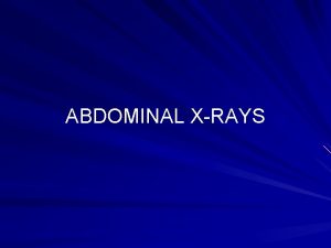 ABDOMINAL XRAYS Plain abdominal Xrays not as useful