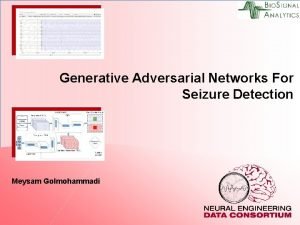 Generative Adversarial Networks For Seizure Detection Meysam Golmohammadi