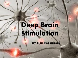 Deep Brain Stimulation By Lisa Rosenberg What is