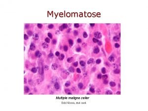 Myelomatose Multiple maligne celler Erik Nilsson stud med