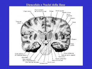 Commessura abenulare