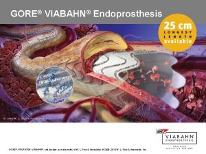 GORE VIABAHN Endoprosthesis GORE VIABAHN and designs are