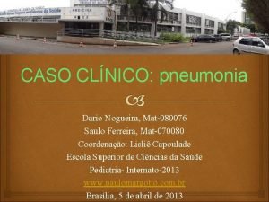 Derrame pleural rx