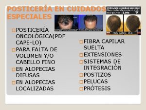 Capelo extensiones