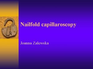Nailfold capillaroscopy Joanna Zalewska Definition best method to
