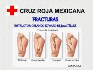 CRUZ ROJA MEXICANA FRACTURAS INSTRUCTOR ORLANDO EDWARD DE